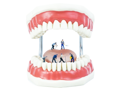 Dental Lab Consumables